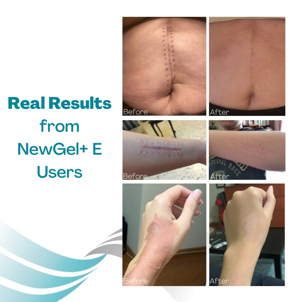 A clinic-style image conveys trusted, physician-informed scar care.