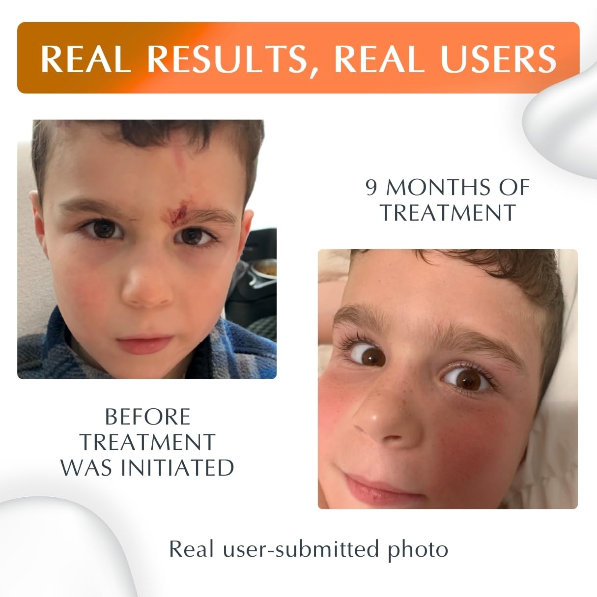 MyNewGel Plus UV sunscreen label highlighting SPF 30