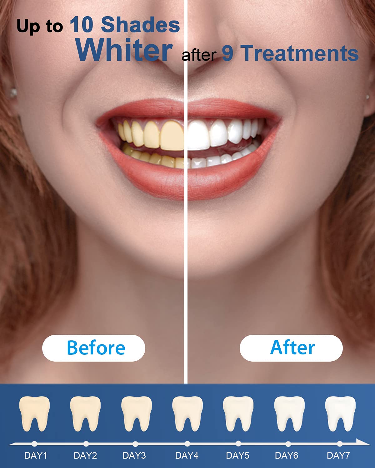 MySmile non-sensitive whitening formula suitable for sensitive teeth.