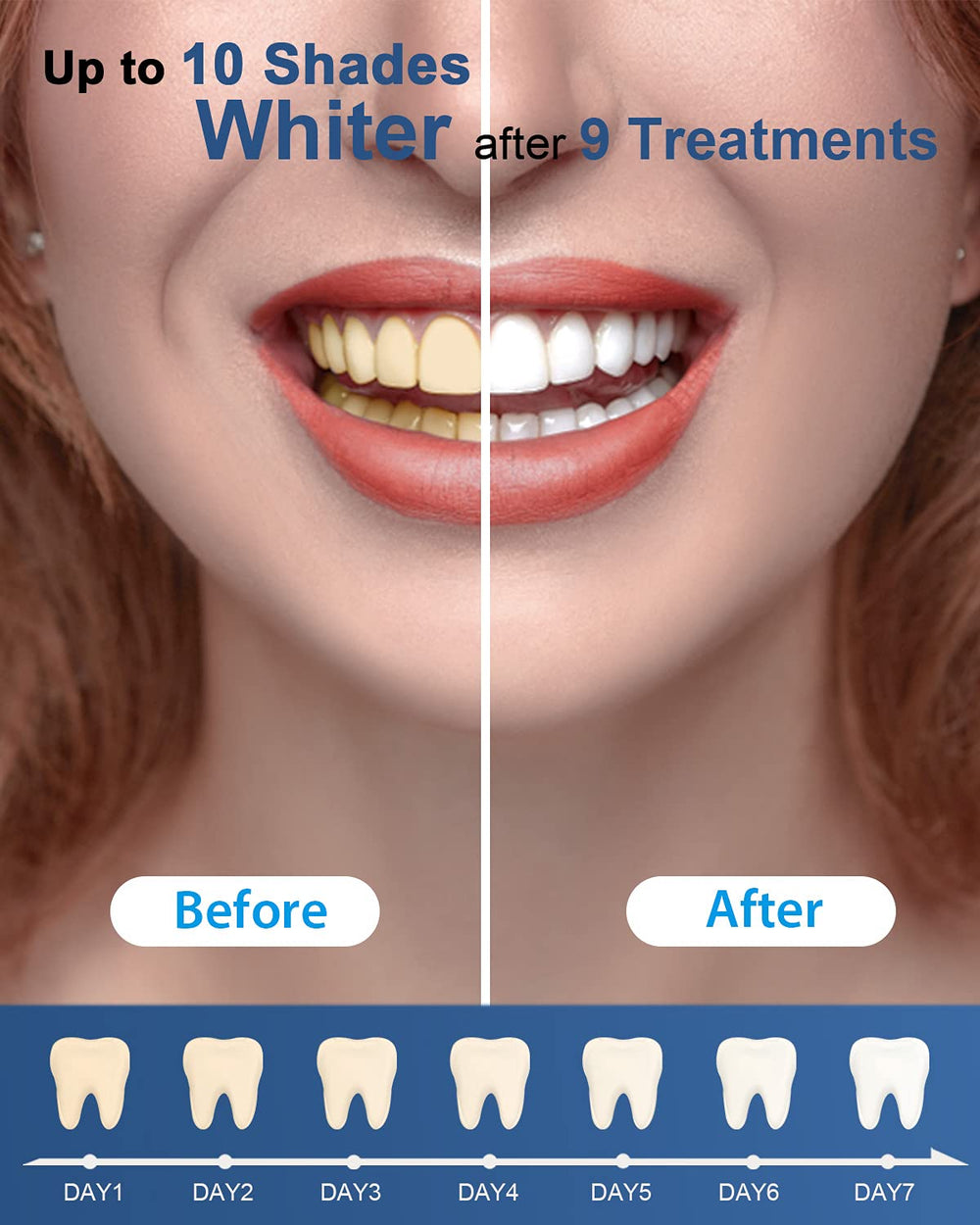 MySmile non-sensitive whitening formula suitable for sensitive teeth.