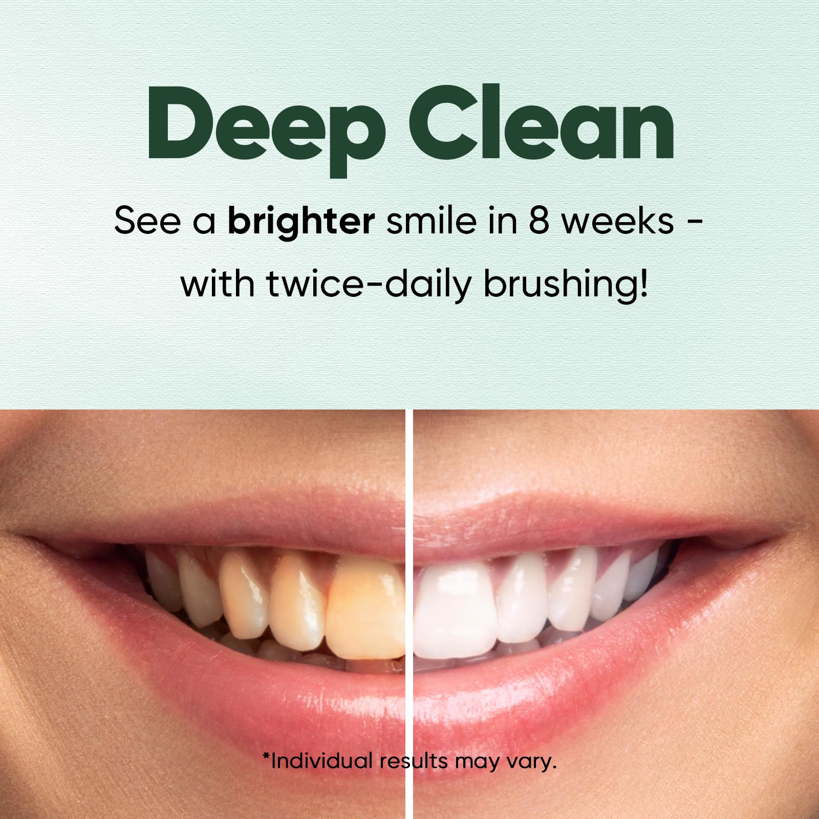MySmile xylitol and baking soda formula helps neutralize acids and plaque.