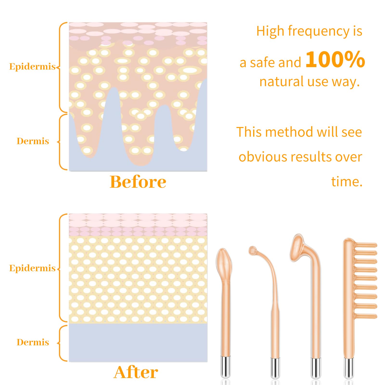 MYSWEETY replaceable attachment head for versatile skincare routines.