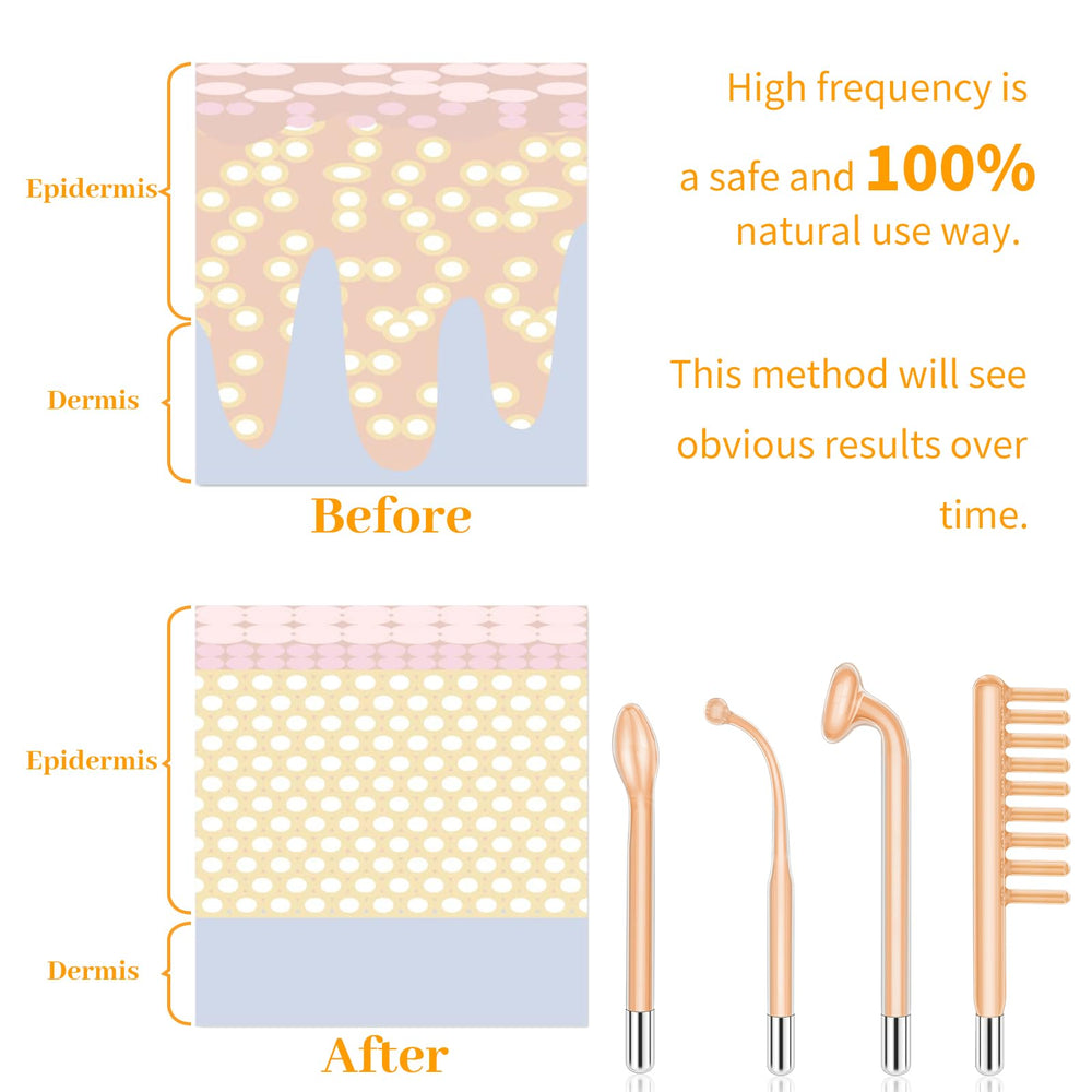 MYSWEETY replaceable attachment head for versatile skincare routines.