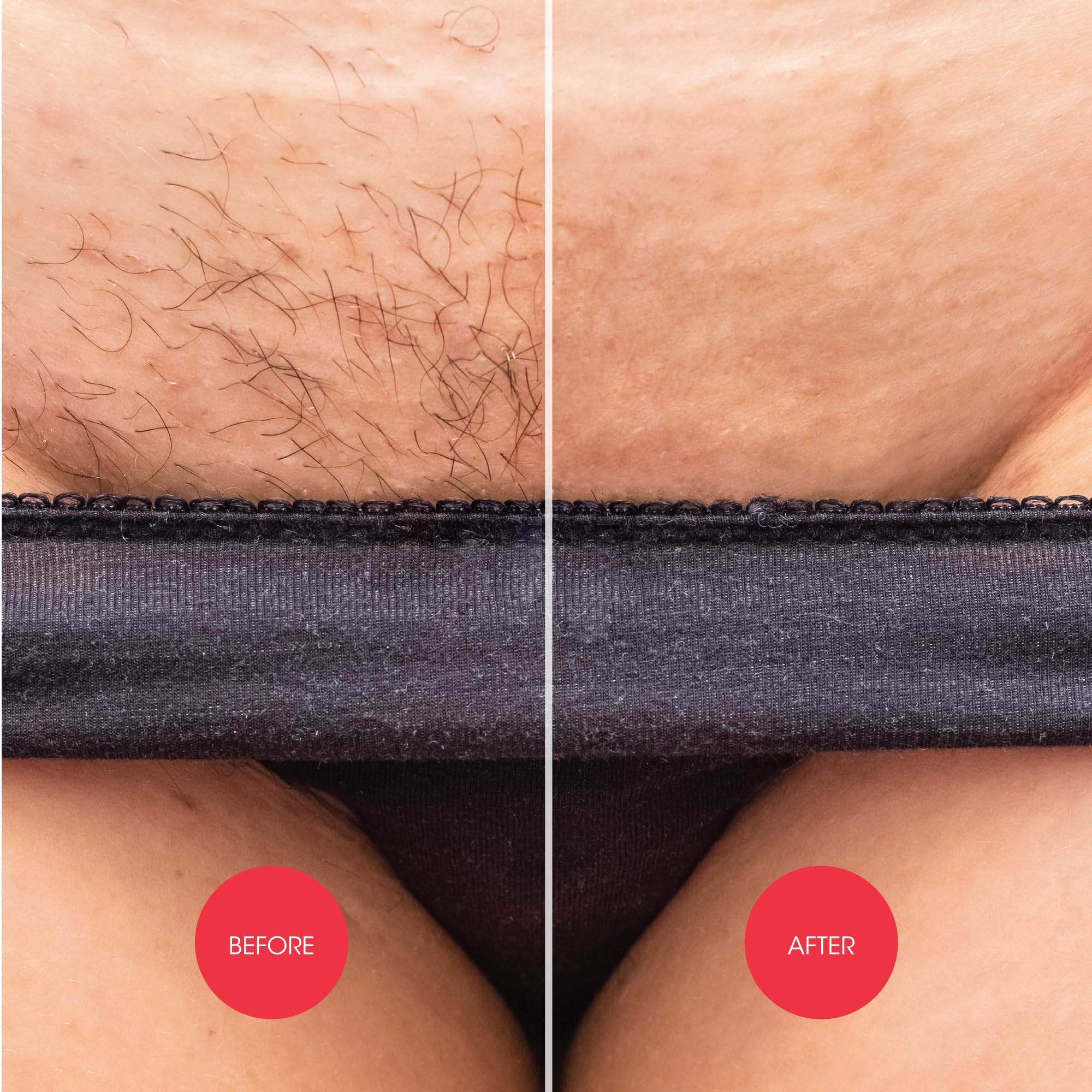 Nad's Down Under Cream hair removal action shows quick 4-minute treatment.