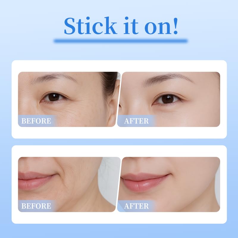Natener patches contain collagen and peptides to support skin texture.