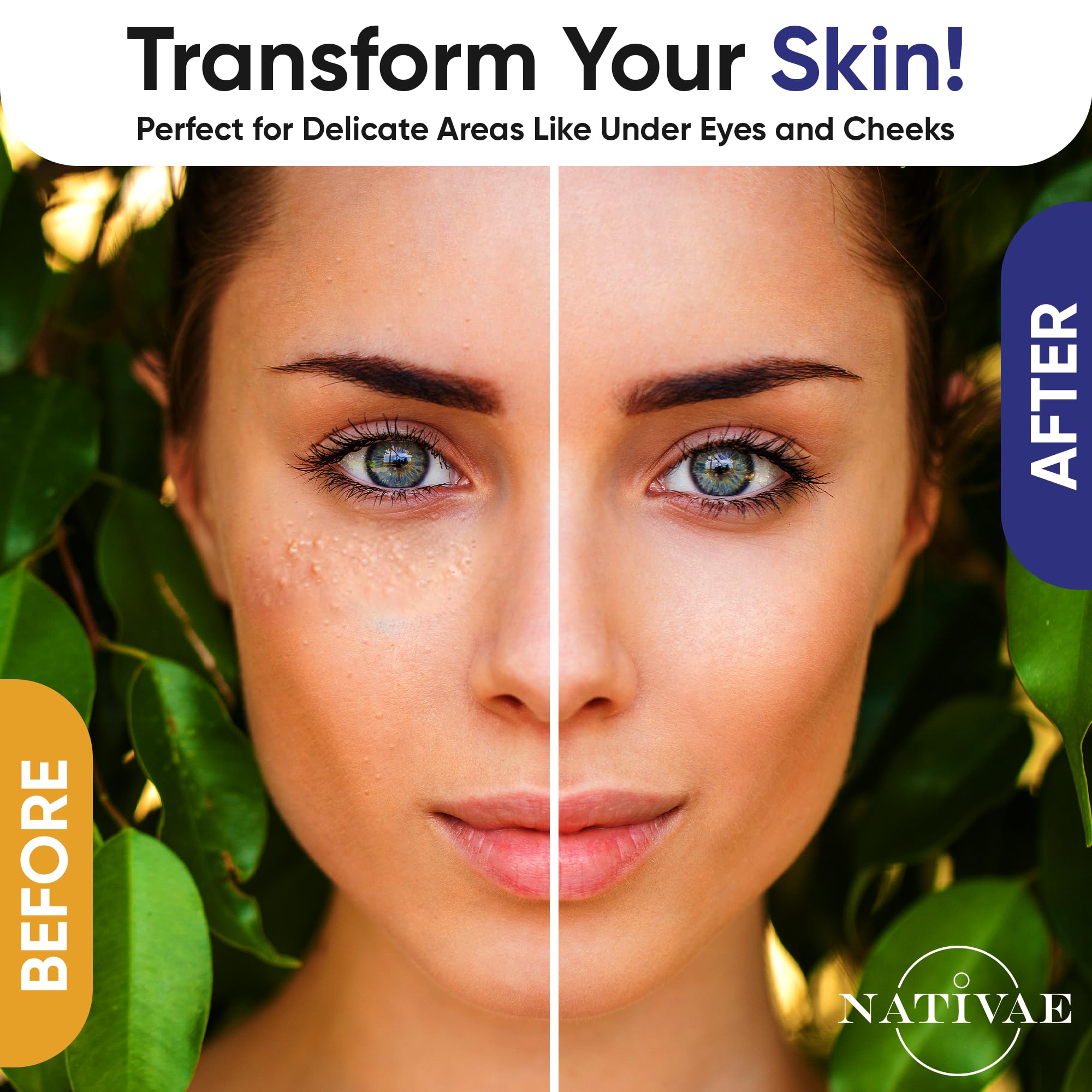 Nativae Milia Remover nose-area treatment for careful milia reduction and improved clarity.