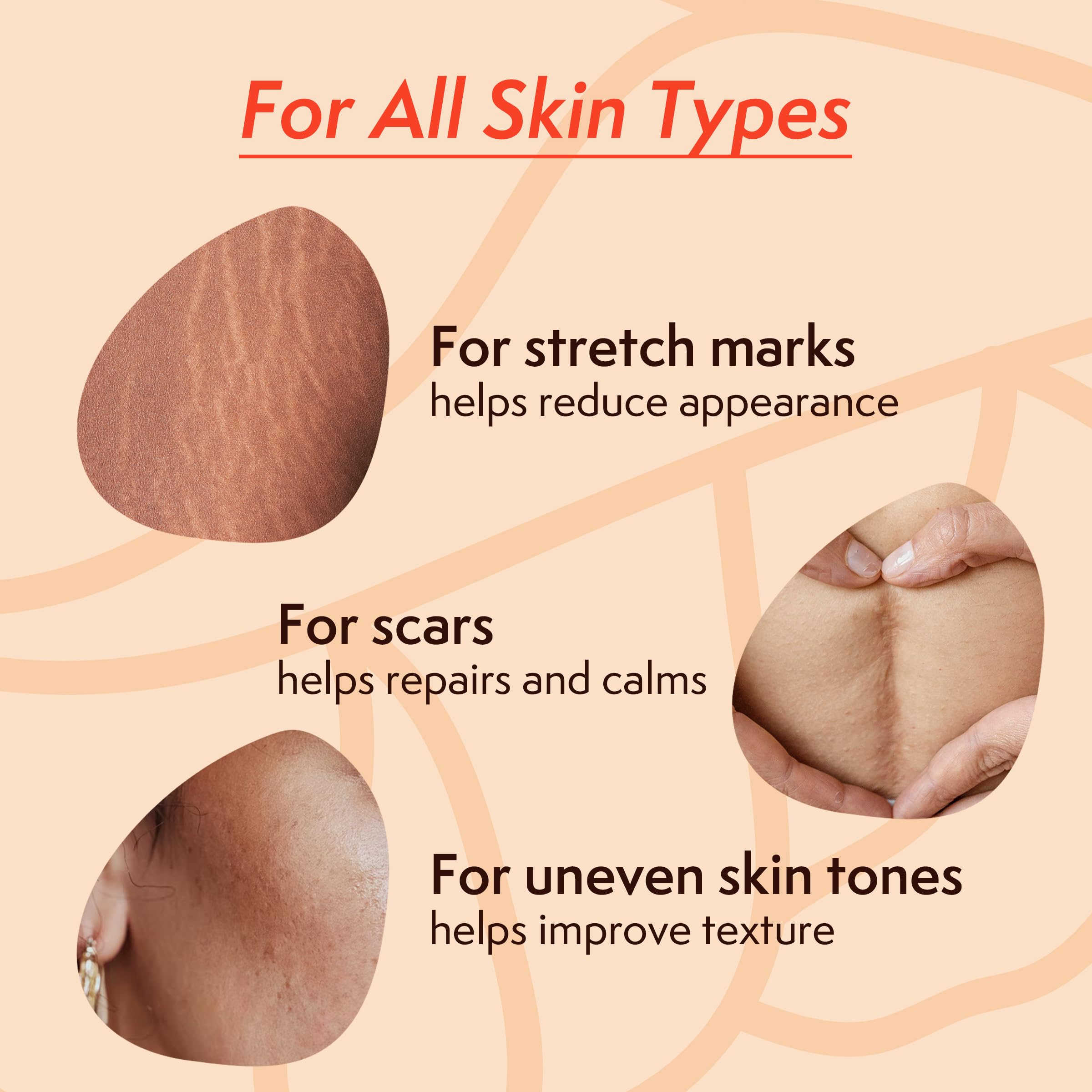 Nature Spell Stretch Mark Oil application on skin promotes hydration and smooth texture.