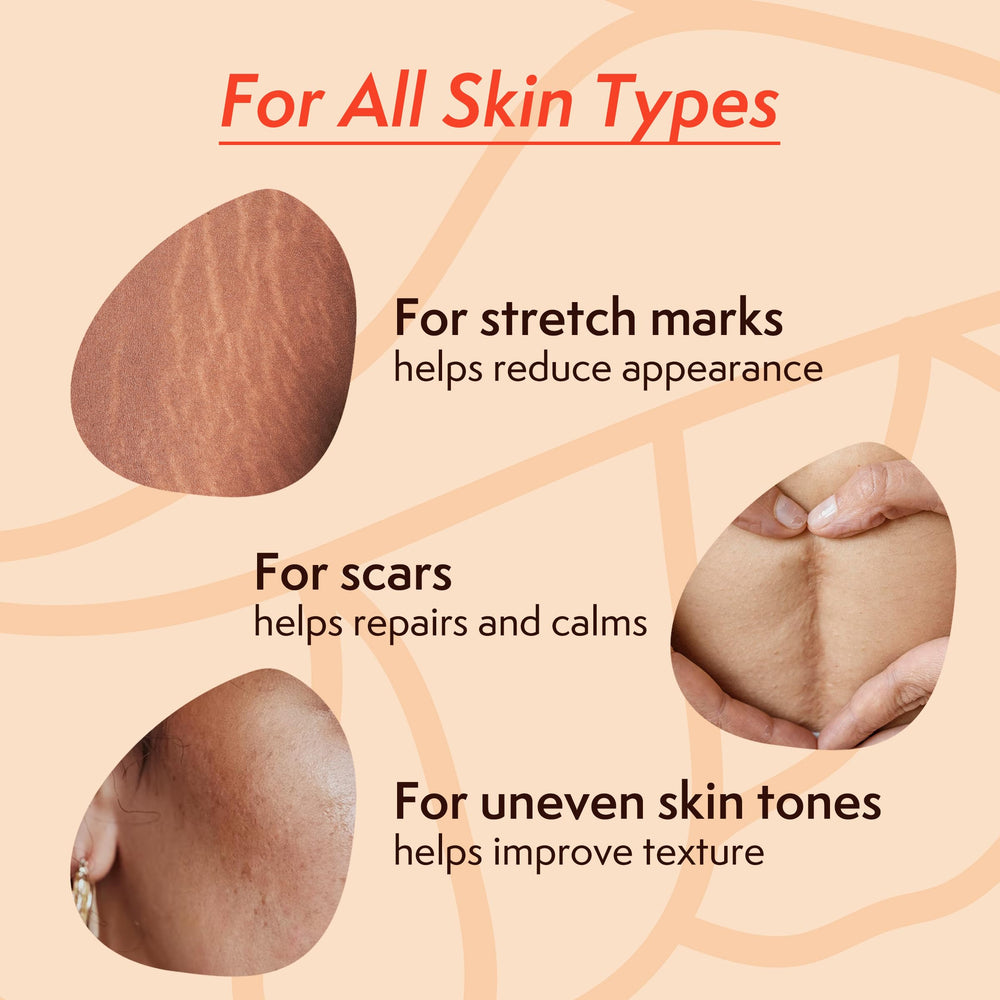 Nature Spell Stretch Mark Oil application on skin promotes hydration and smooth texture.