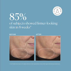 Bakuchiol and plant-derived retinol ingredients in Naturium formula