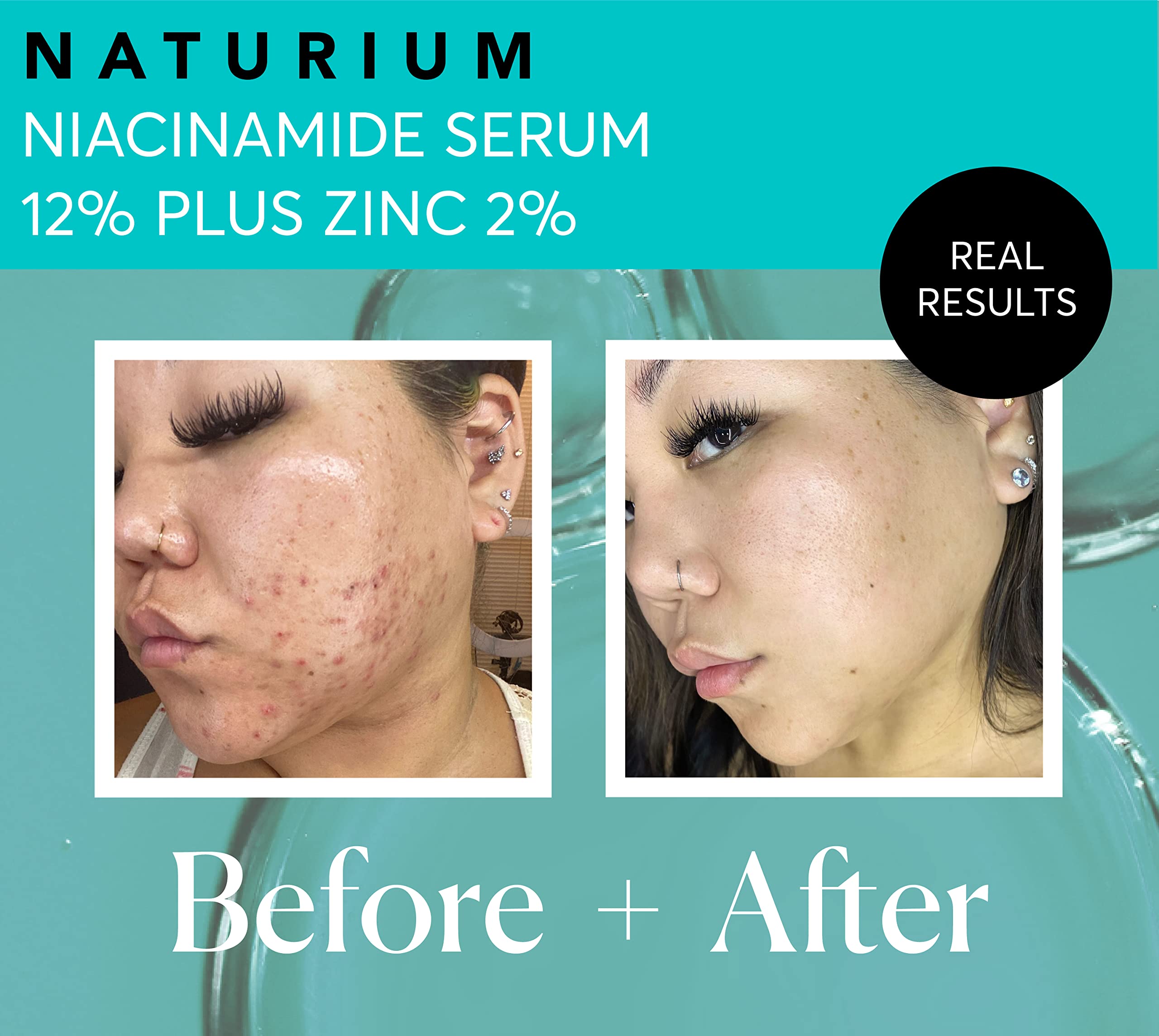 Naturium serum texture appears smooth and fast absorbing on skin