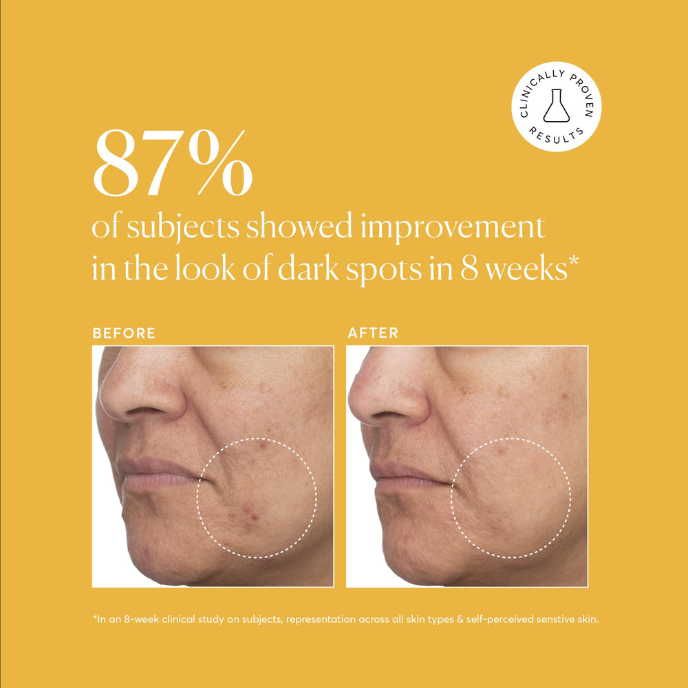 Naturium Tranexamic 5% pH-friendly label communicates skin compatibility