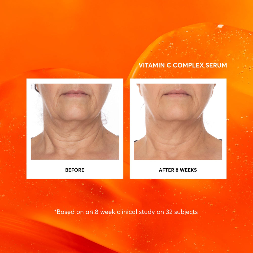 Naturium serum emphasizes L-ascorbic acid and stable vitamin C formula