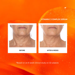 Naturium serum emphasizes L-ascorbic acid and stable vitamin C formula