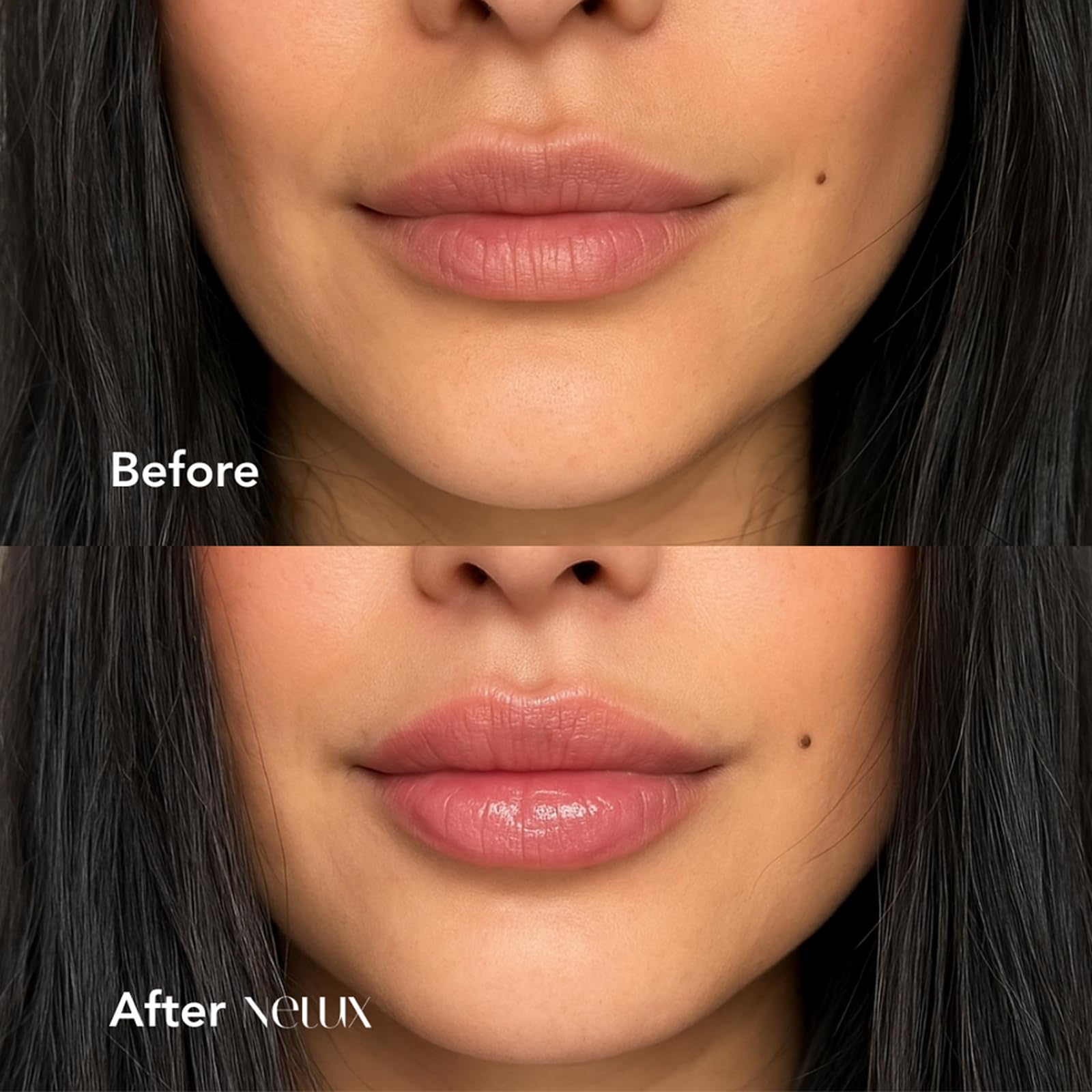 Nelux Hyaluronic Lip Plumper application shows precise, hygienic wand use