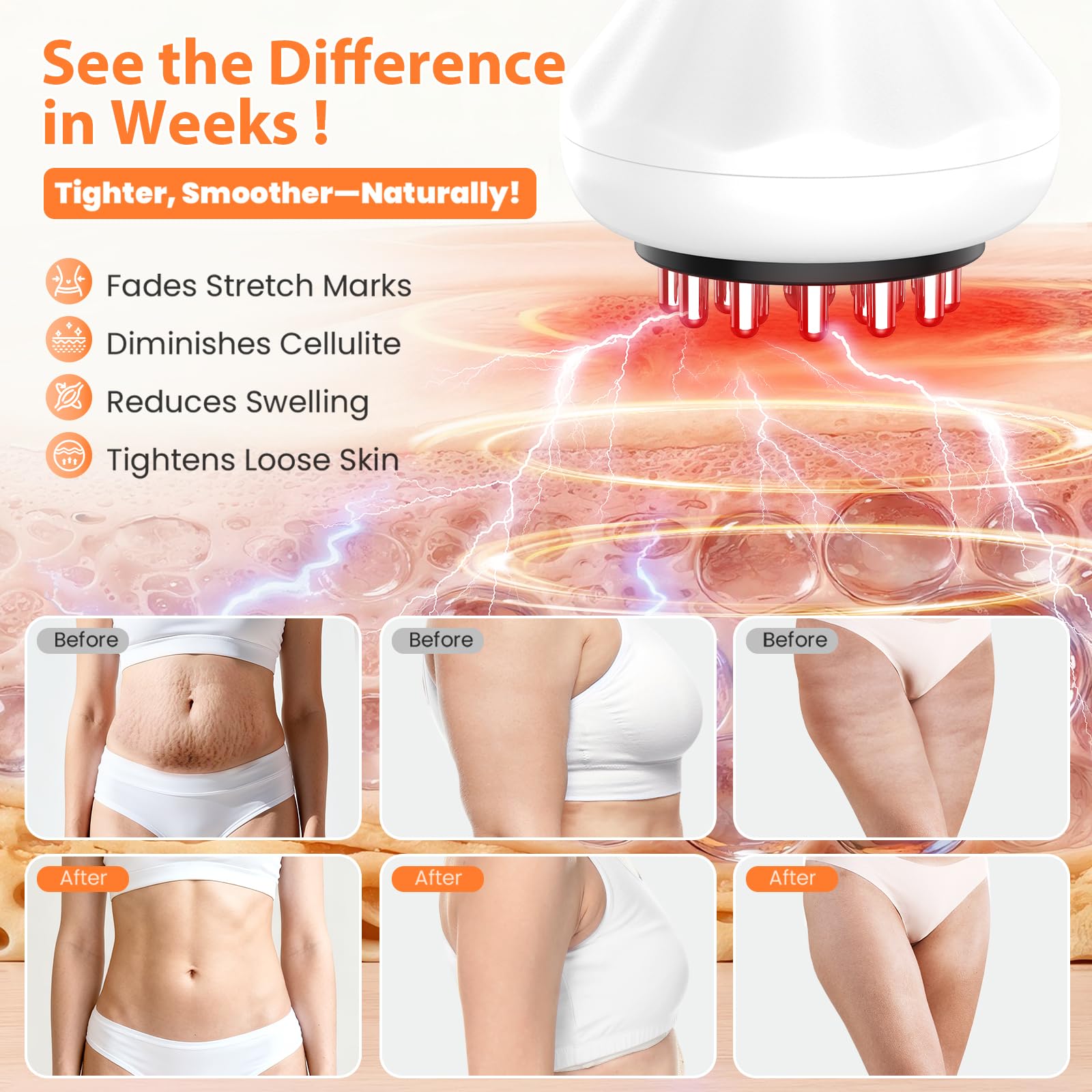 NENRENT Body Sculpting Machine application on thigh illustrates full body use