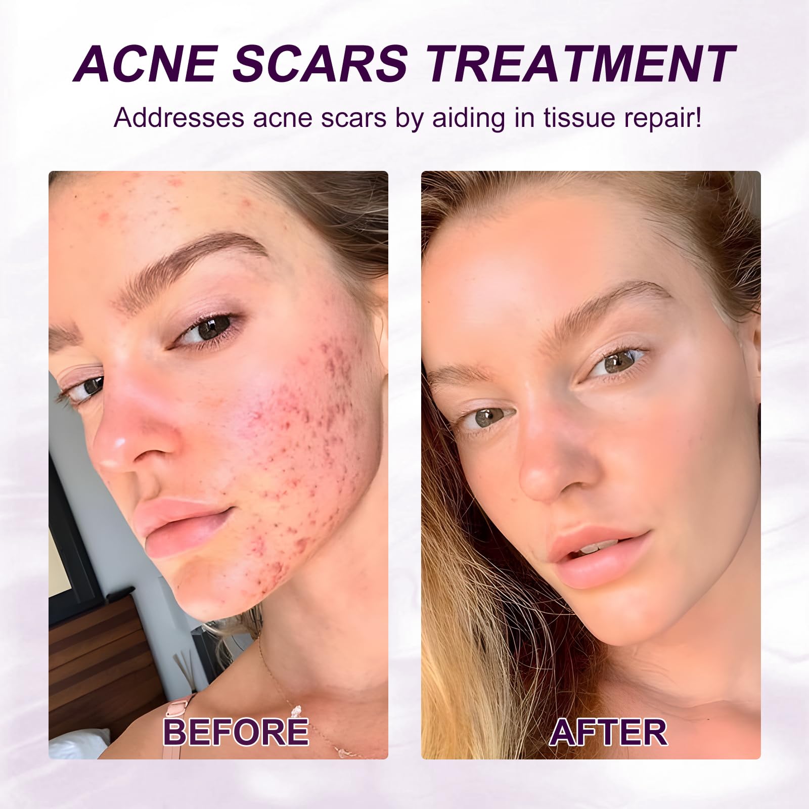 Netwik Niacinamide and Hyaluronic Acid ingredients highlighted for hydration boost.