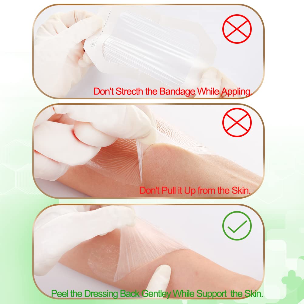 NEUHEILS 100-piece box of clear film dressings for reliable coverage