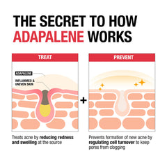 Neutrogena Adapalene Gel 0.1% on hand for convenient spot treatment