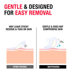 Neutrogena clear patch on zit demonstrating discreet acne care