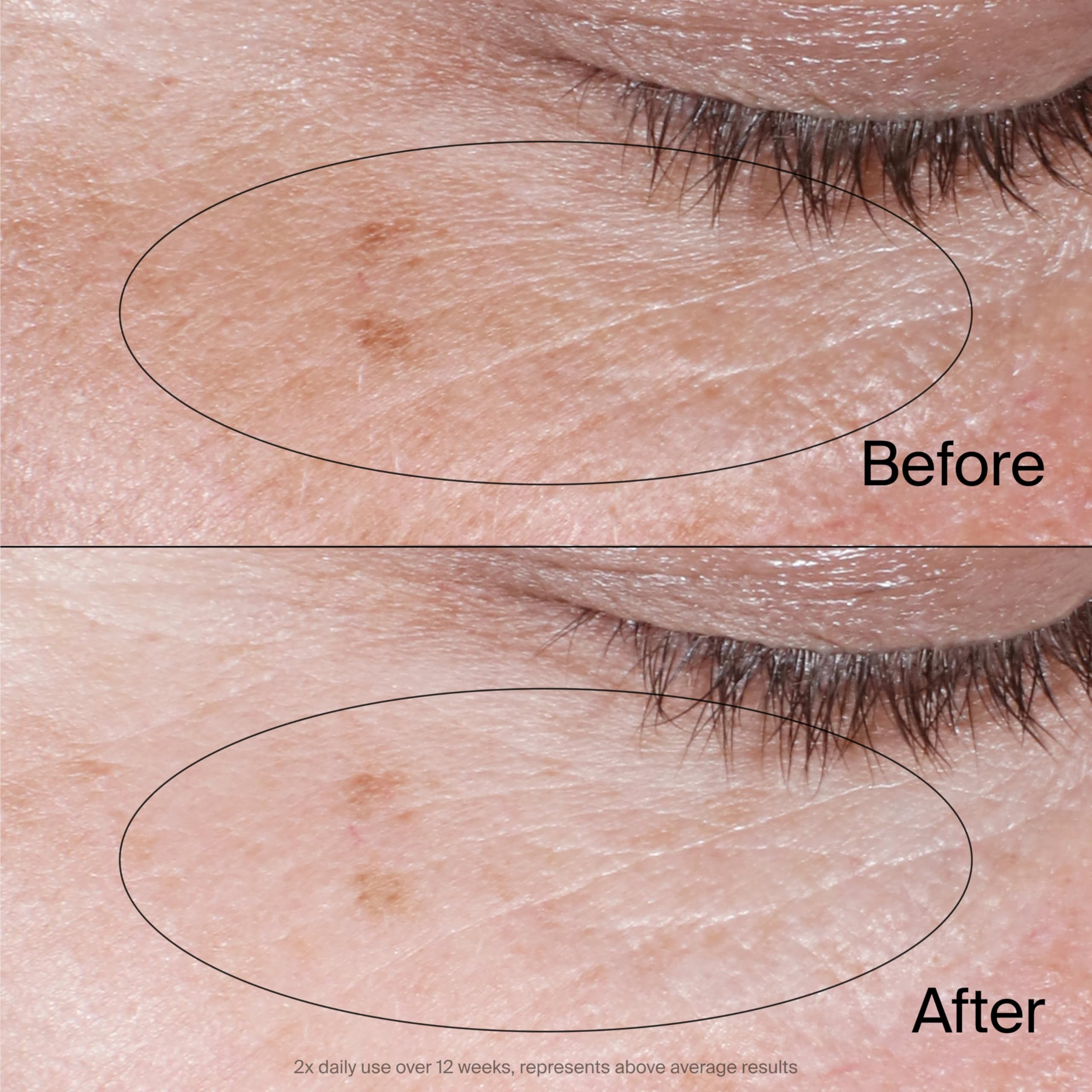 Fragrance-free Neutrogena eye cream suitable for sensitive skin.