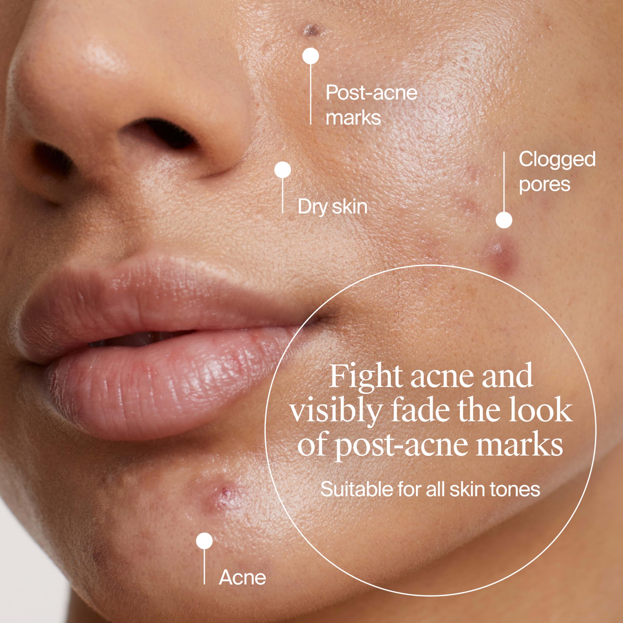Neutrogena Evenly Clear moisturizer tube with cap open shows product dispersion.