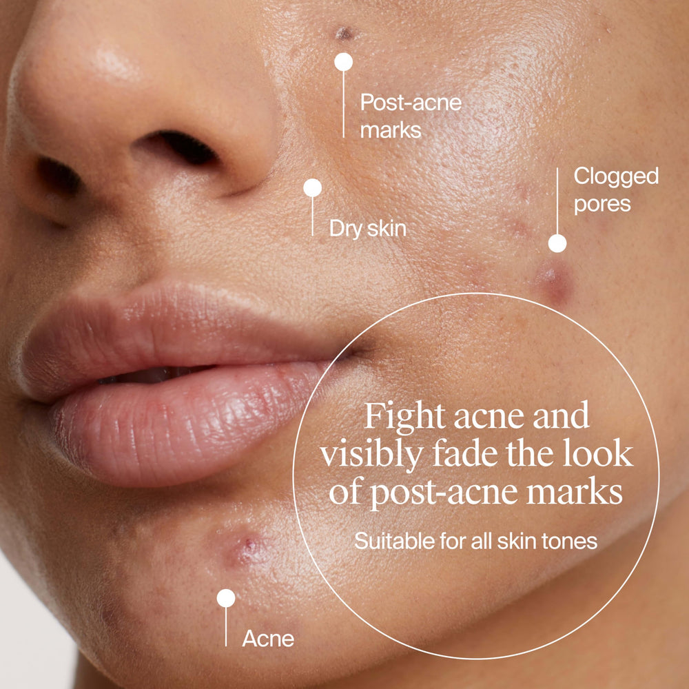 Neutrogena Evenly Clear moisturizer tube with cap open shows product dispersion.