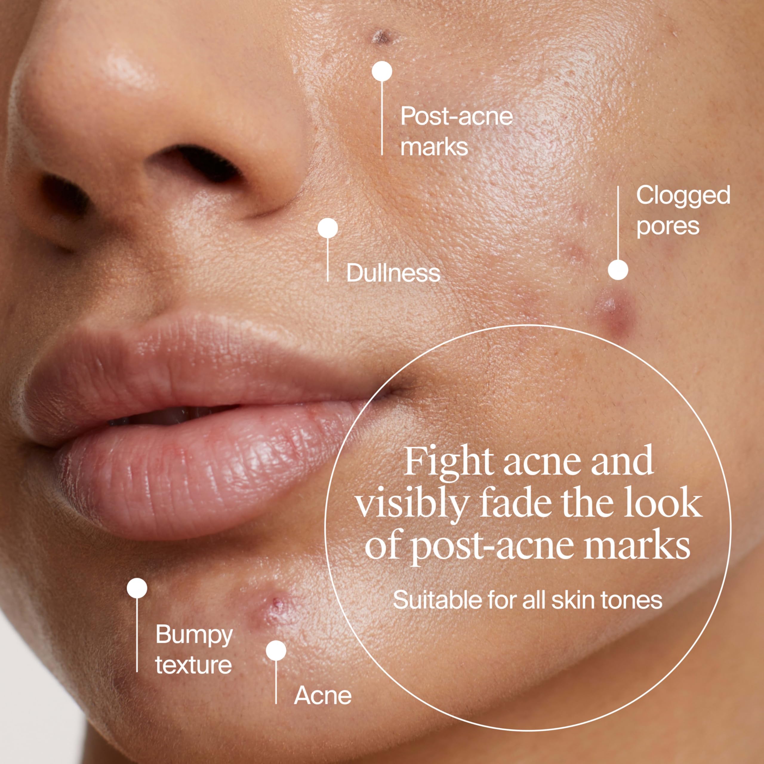 Neutrogena Evenly Clear applying on the face for a smooth, balanced complexion