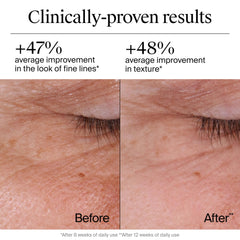 Neutrogena fragrance-free anti-aging cream packaging shows clean, irritation-conscious formula
