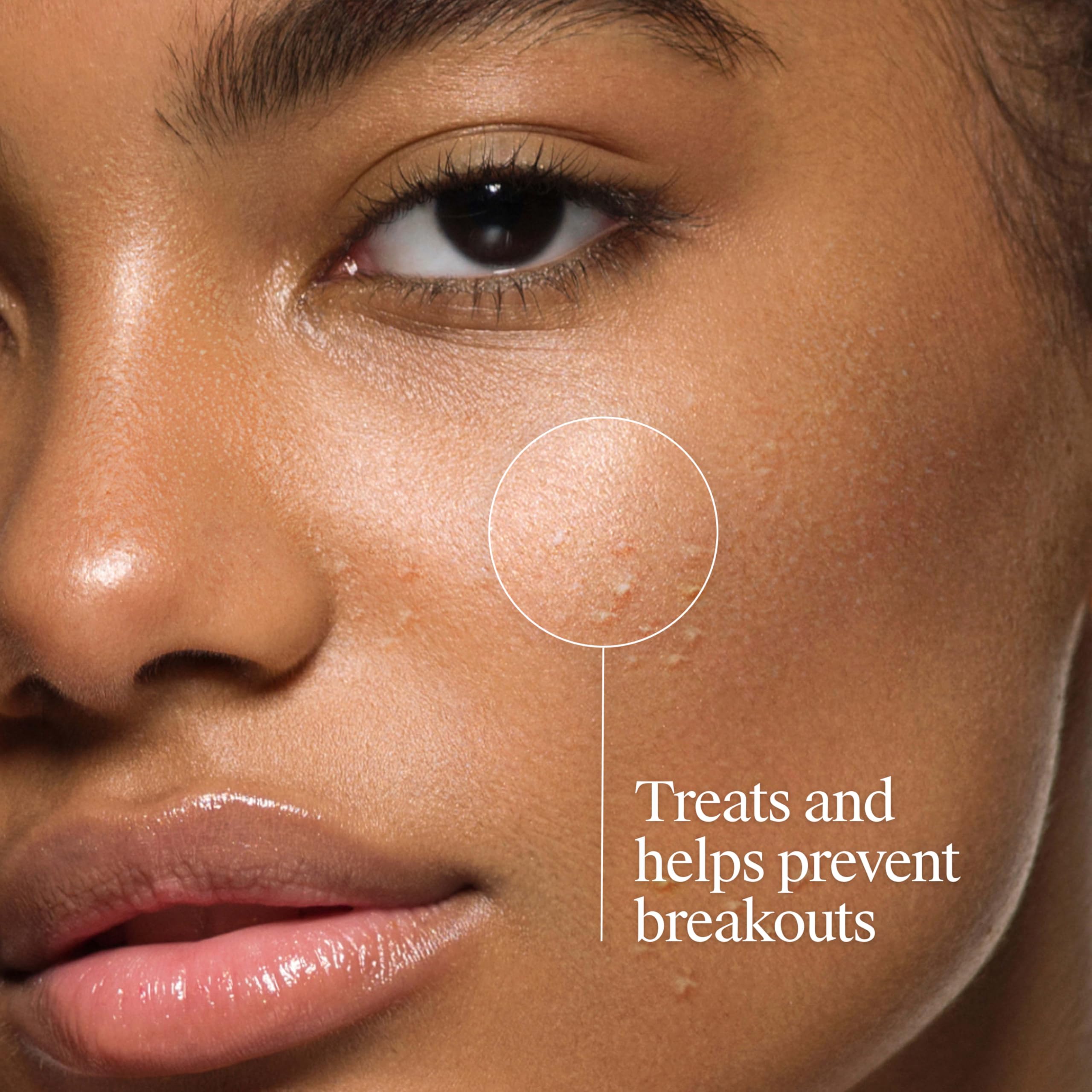 Close-up of 2% salicylic acid note on Neutrogena acne cleanser.