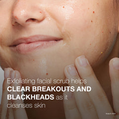 Neutrogena Oil-Free Acne Wash Pink Grapefruit close-up on face during cleanse