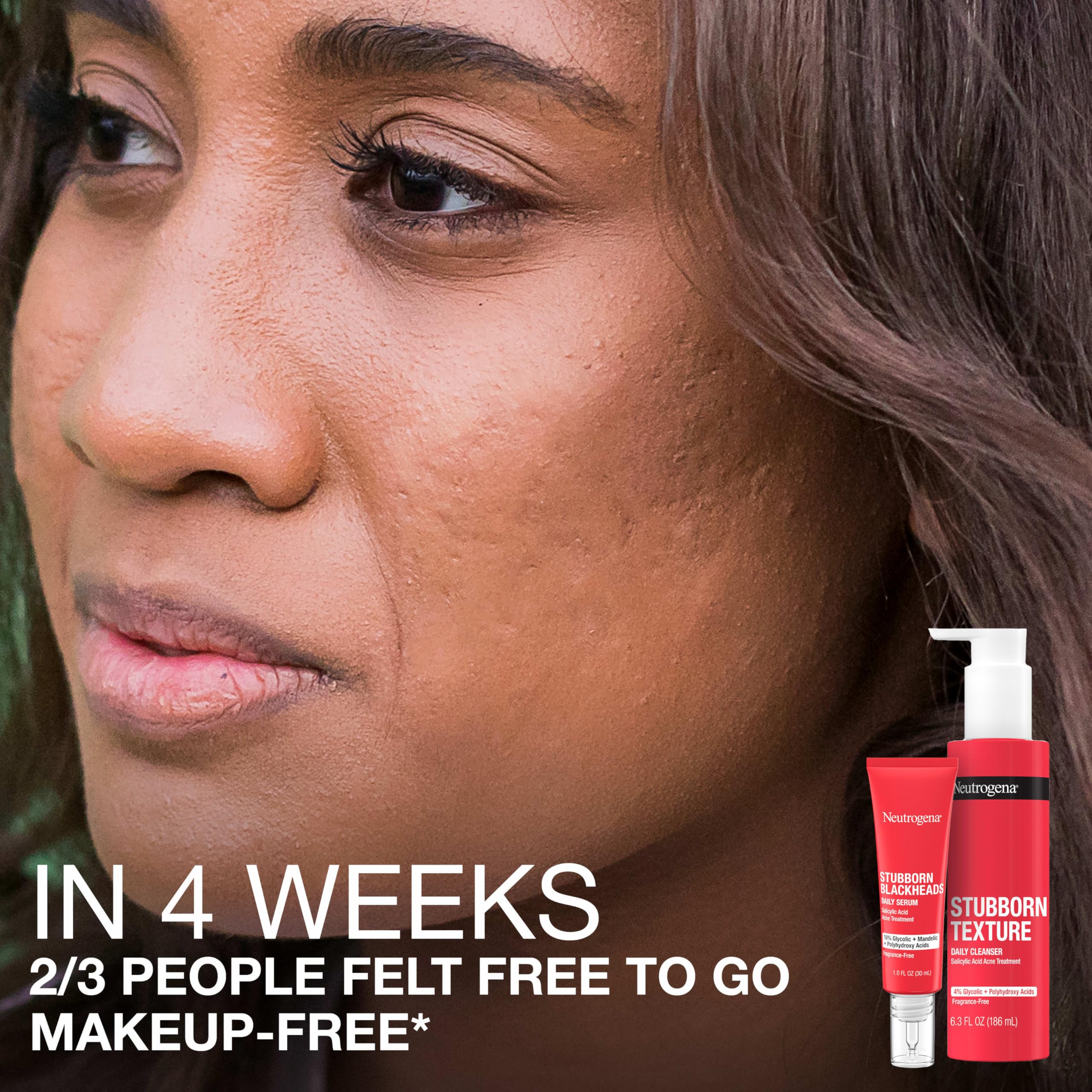 Neutrogena Stubborn Blackheads serum bottle labeled oil-free.
