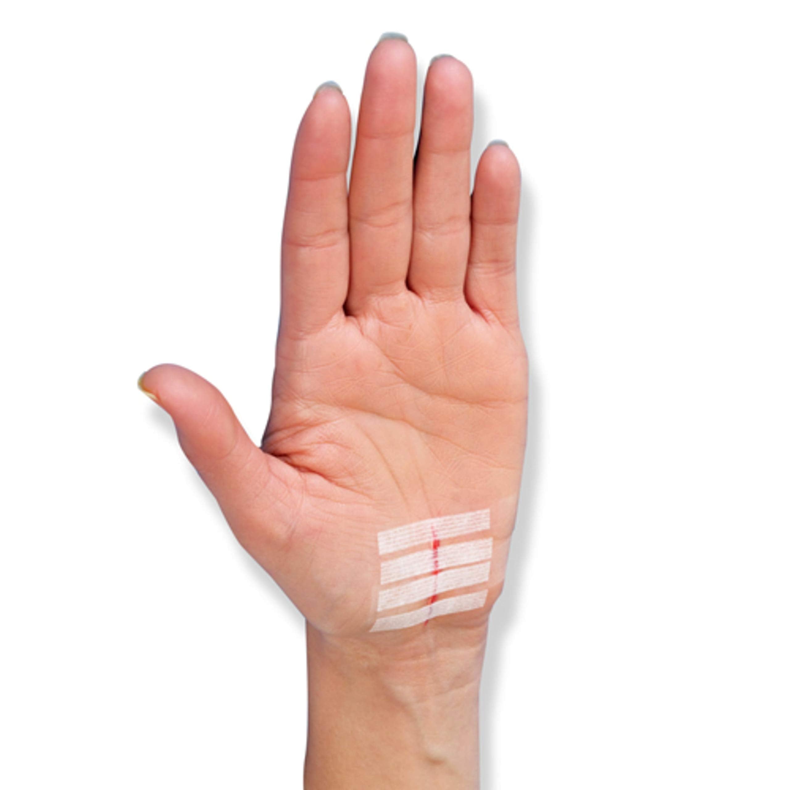 Nexcare Steri-Strip 30-pack offers versatile wound closure options