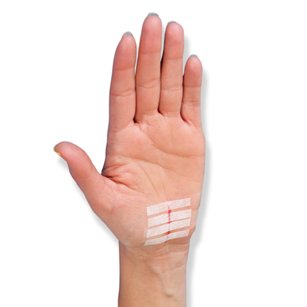 Nexcare Steri-Strip 30-pack offers versatile wound closure options