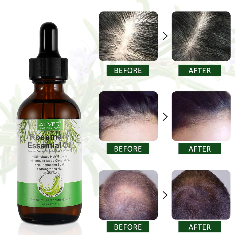 NIFEISHI Rosemary Oil skincare and facial care application