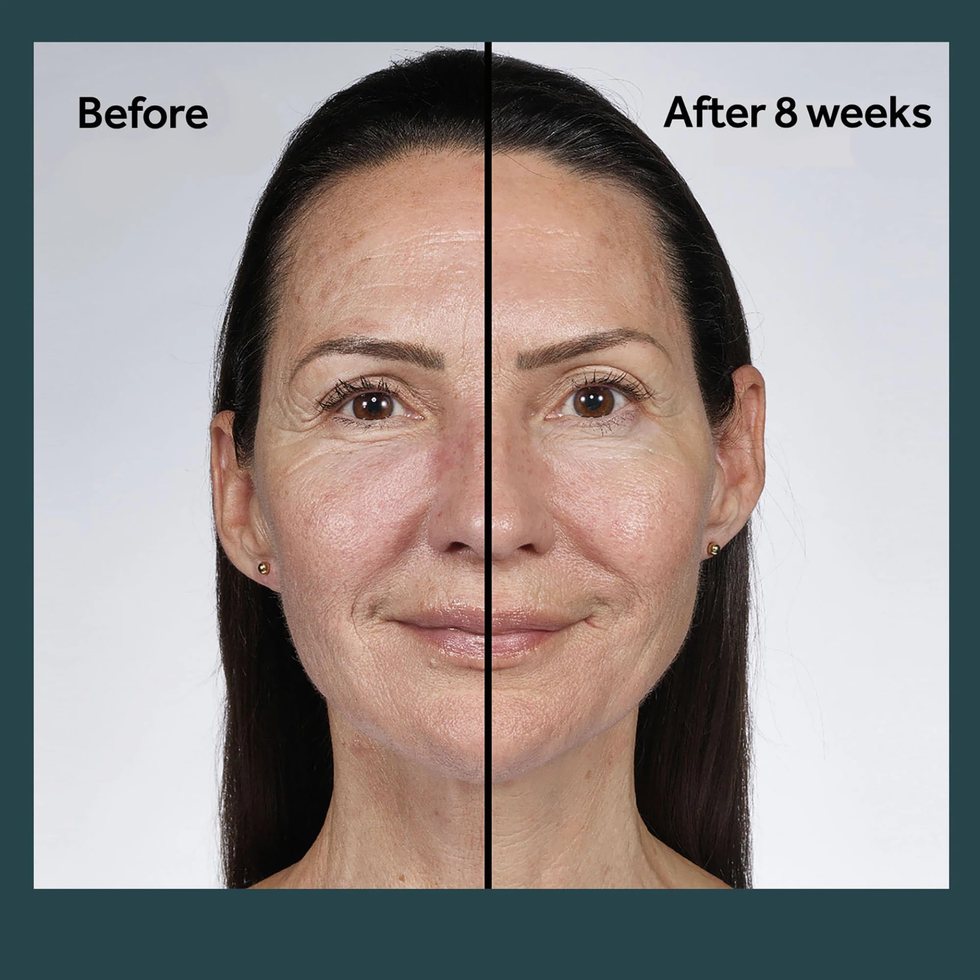 No7 Future Renew packaging shows dermatologist-approved badge for skin-friendly care.