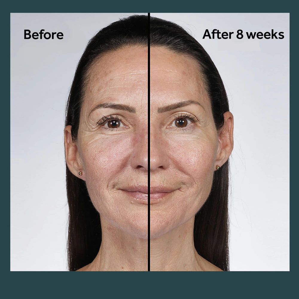 No7 Future Renew packaging shows dermatologist-approved badge for skin-friendly care.