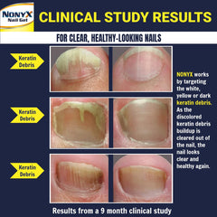 Person applying NONYX gel to address nail discoloration and texture.