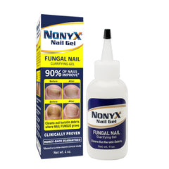 NONYX Fungal Nail Clarifying Gel bottle ready for at-home treatment.