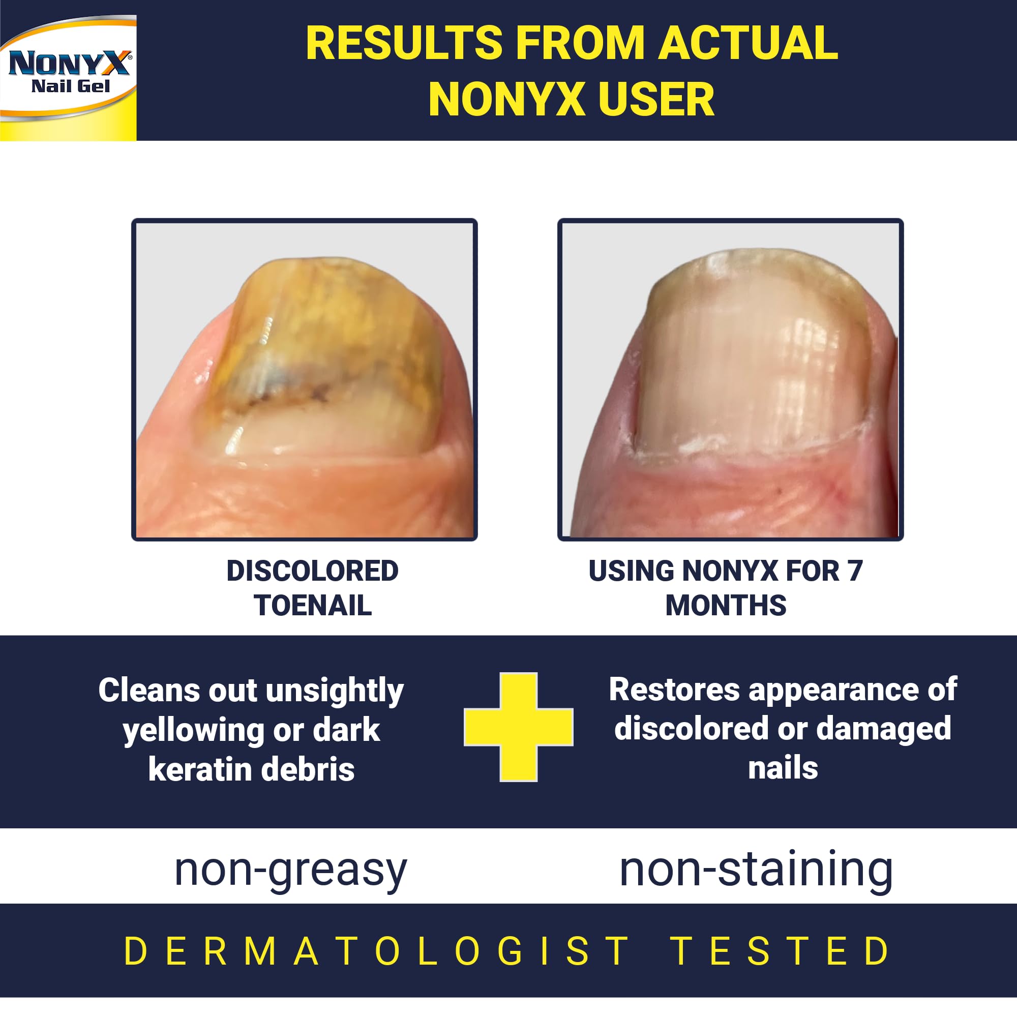 NONYX nails before and after showing improved appearance.