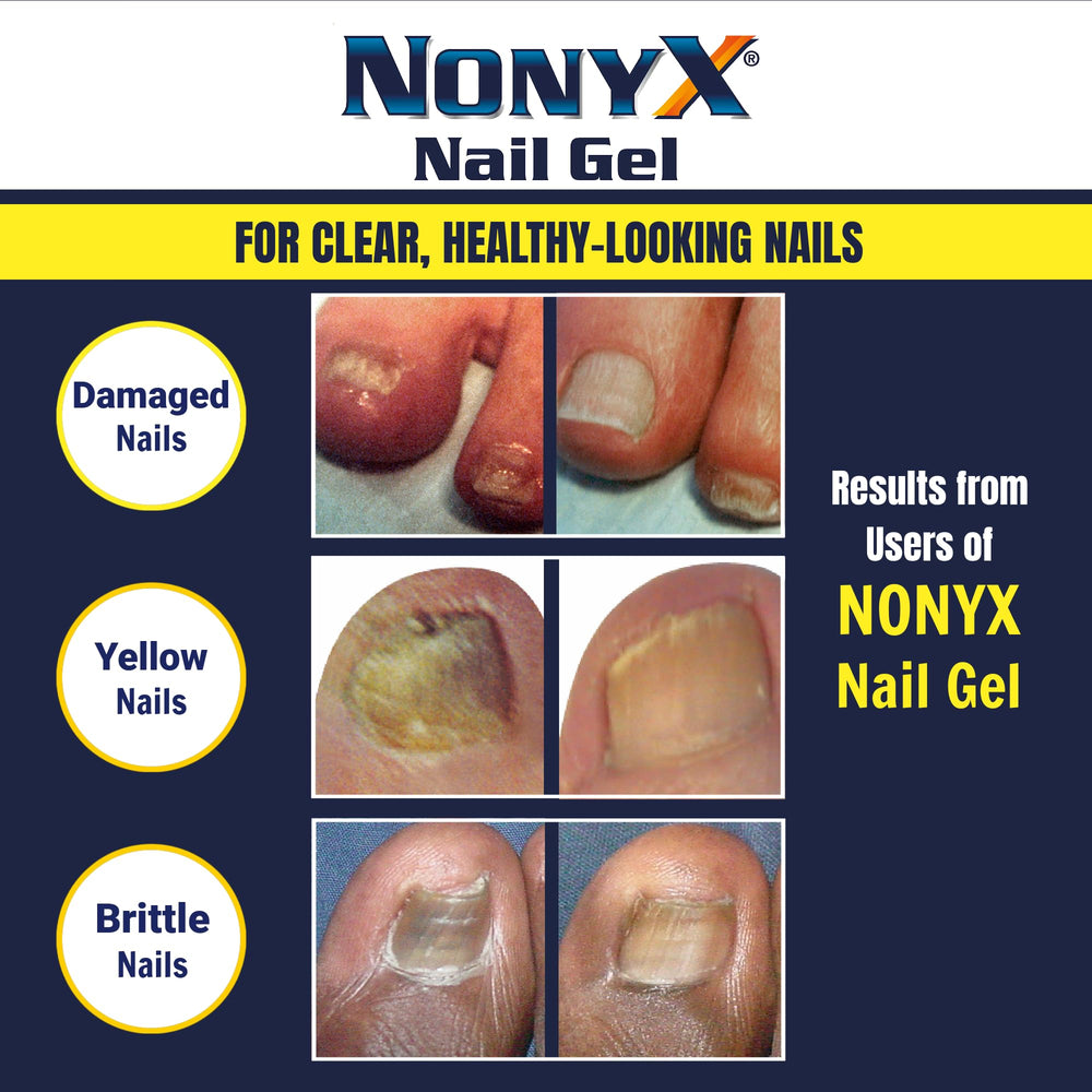 Podiatrist and dermatologist recommendations support NONYX usage.