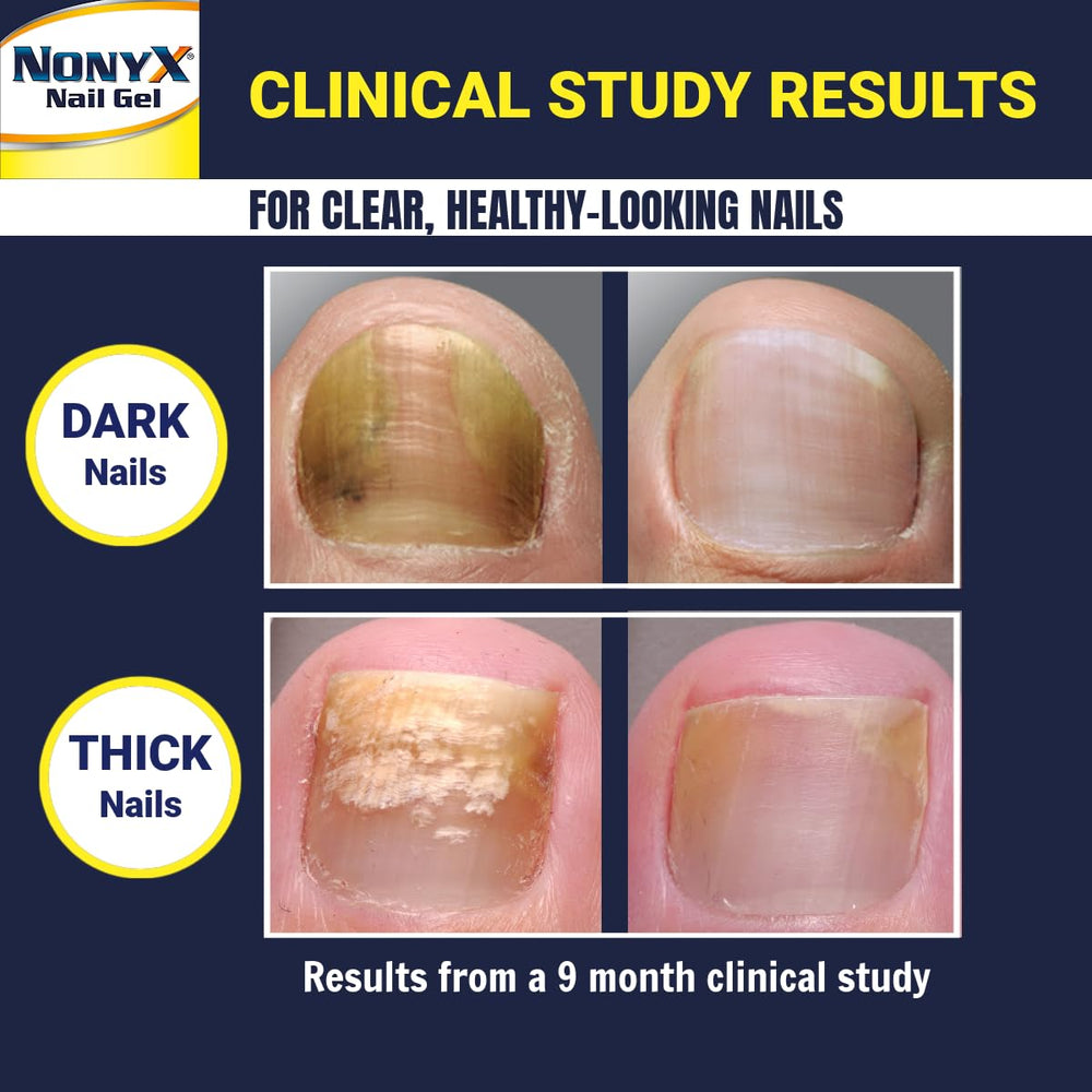 USA-made packaging highlighting authentic NONYX product.
