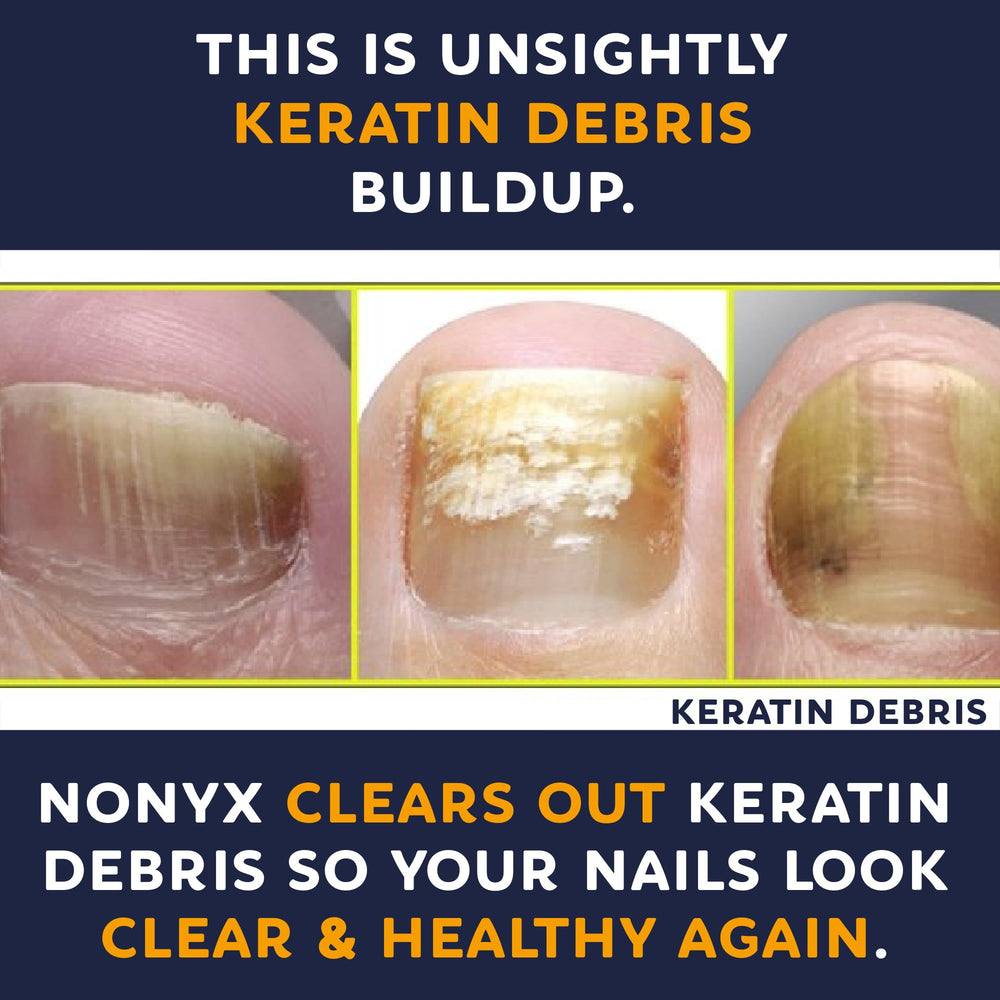NONYX vegan, paraben-free formula dries clear and odor-free.