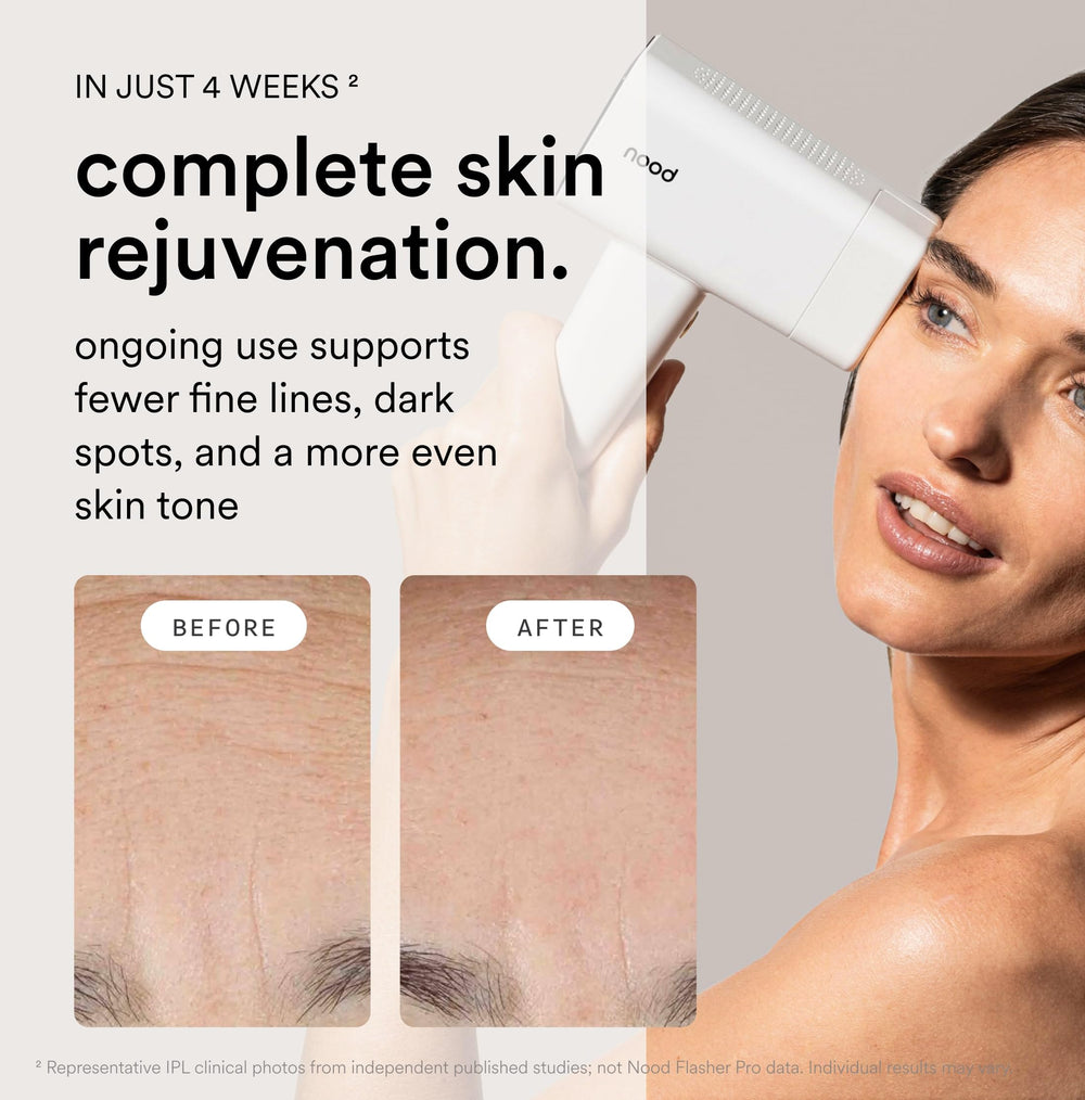 Nood Flasher Pro anti-aging lens swapped for smoother appearance.