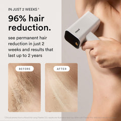 Nood Flasher Pro with CryoSoothe cooling during a session for pain-free use.