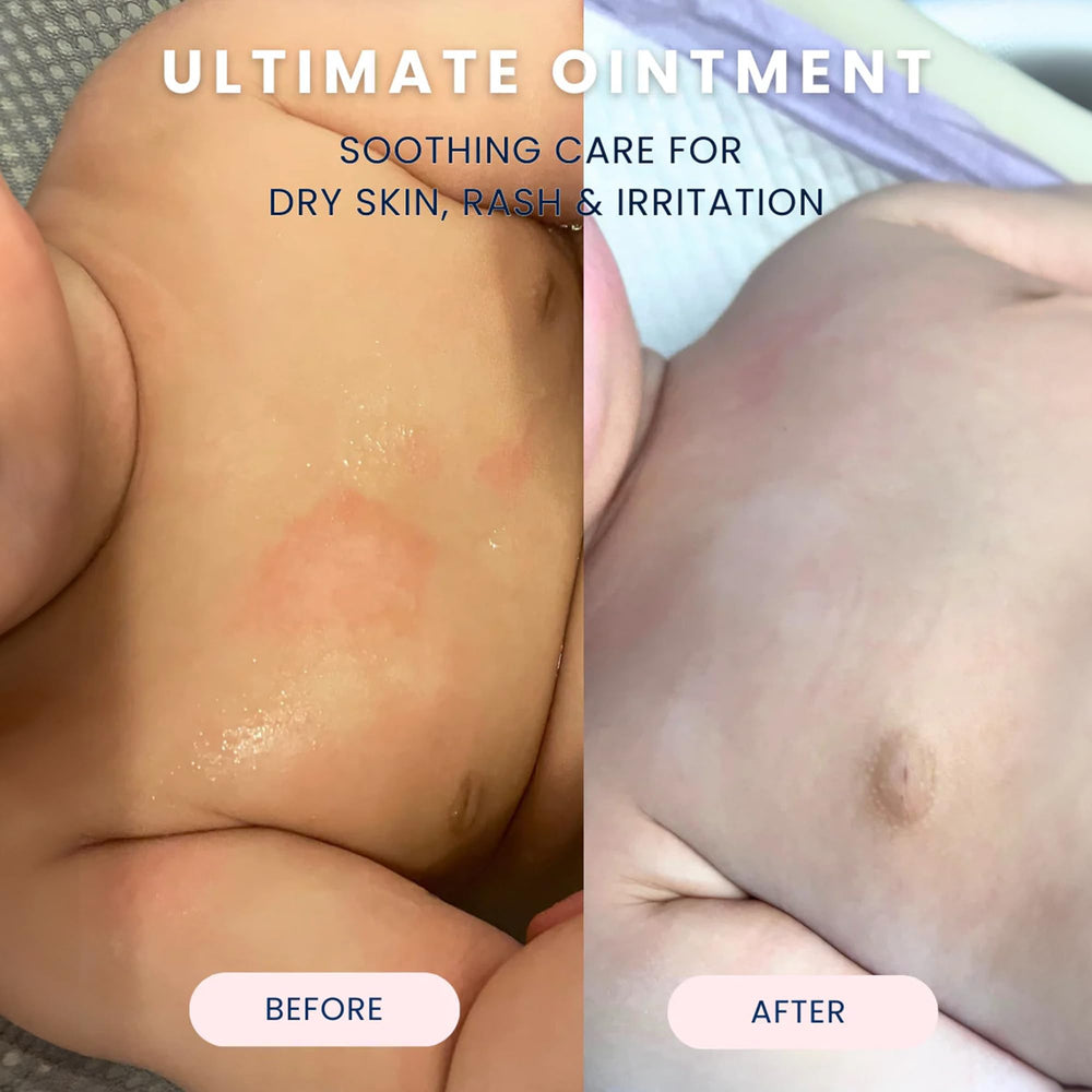 Noodle & Boo dermatologist-tested packaging emphasizing hypoallergenic formulation.