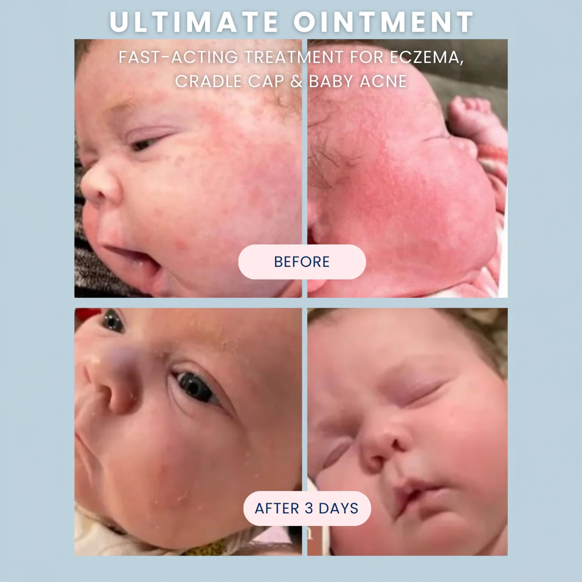 Noodle & Boo fragrance-free label highlights safety for eczema-prone skin.
