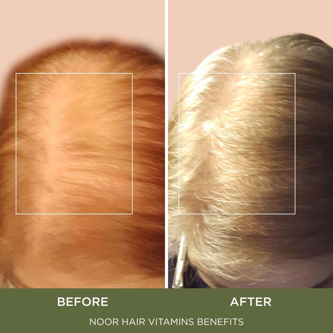 NOOR HAIR ingredient-chart highlights zinc, biotin, and vitamins for scalp nourishment.