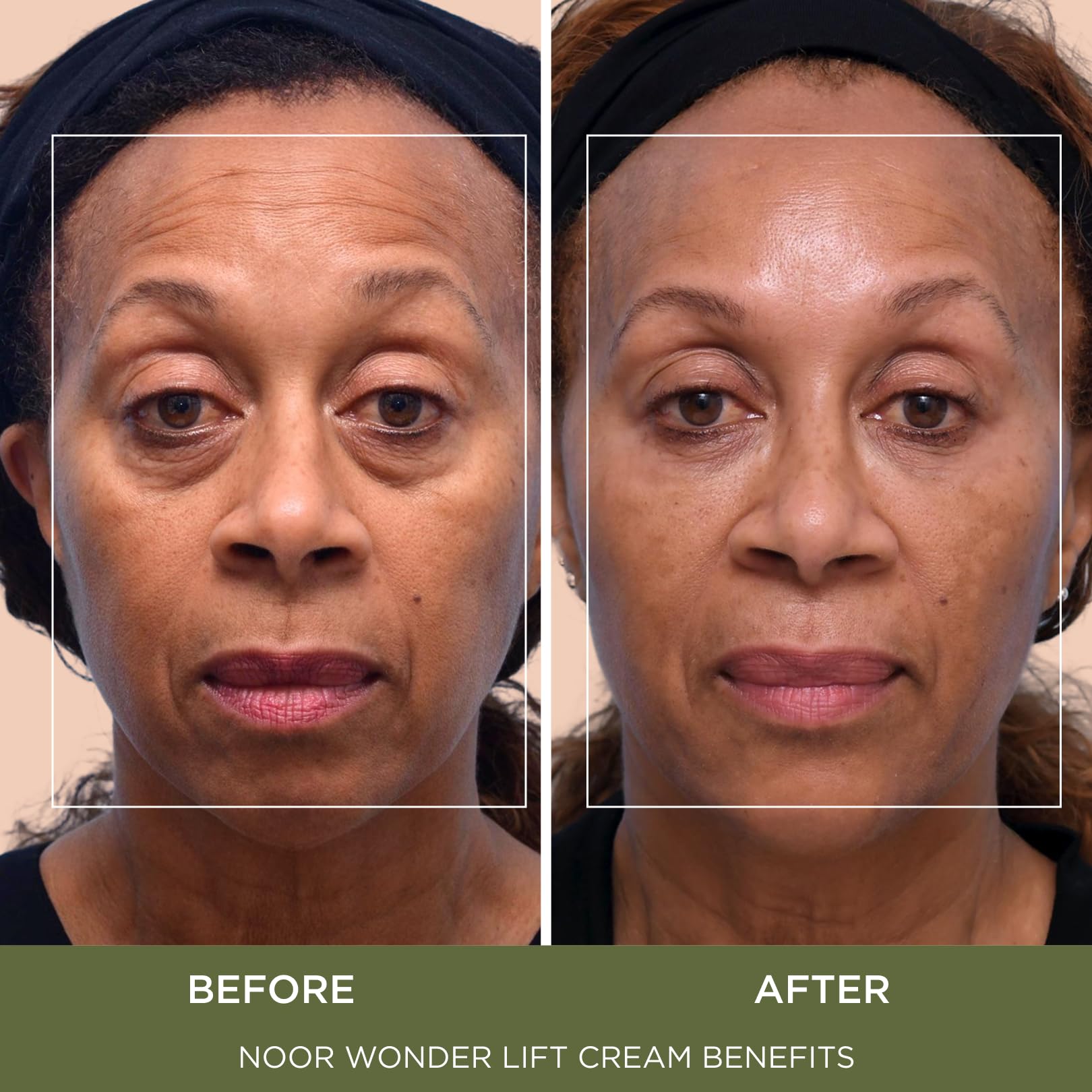 Noor Hair WonderLift cream texture close-up showing light, non-greasy finish.