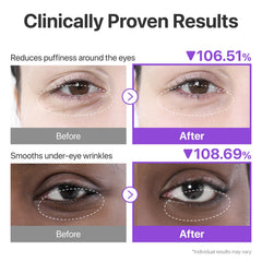 numbuzin No.9 peptides, caffeine, and niacinamide brighten and firm the eye area