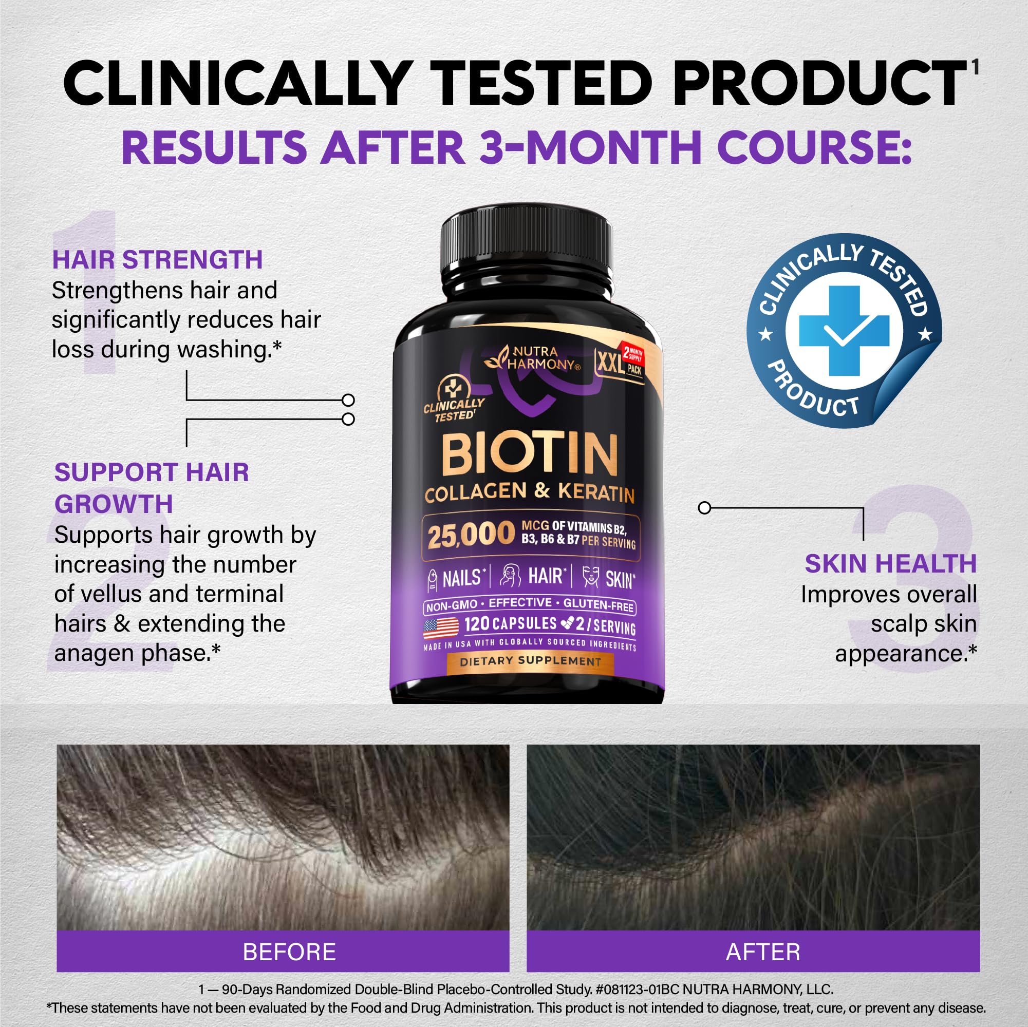 NutraHarmony B-complex graphic shows Biotin 25,000 mcg per serving.